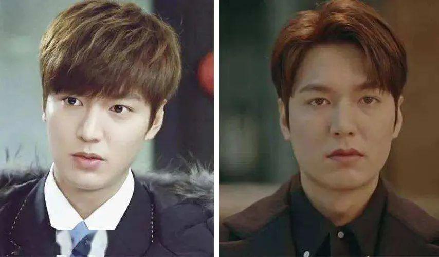 发腮和塌腮哪个更显老,发腮真的显老吗