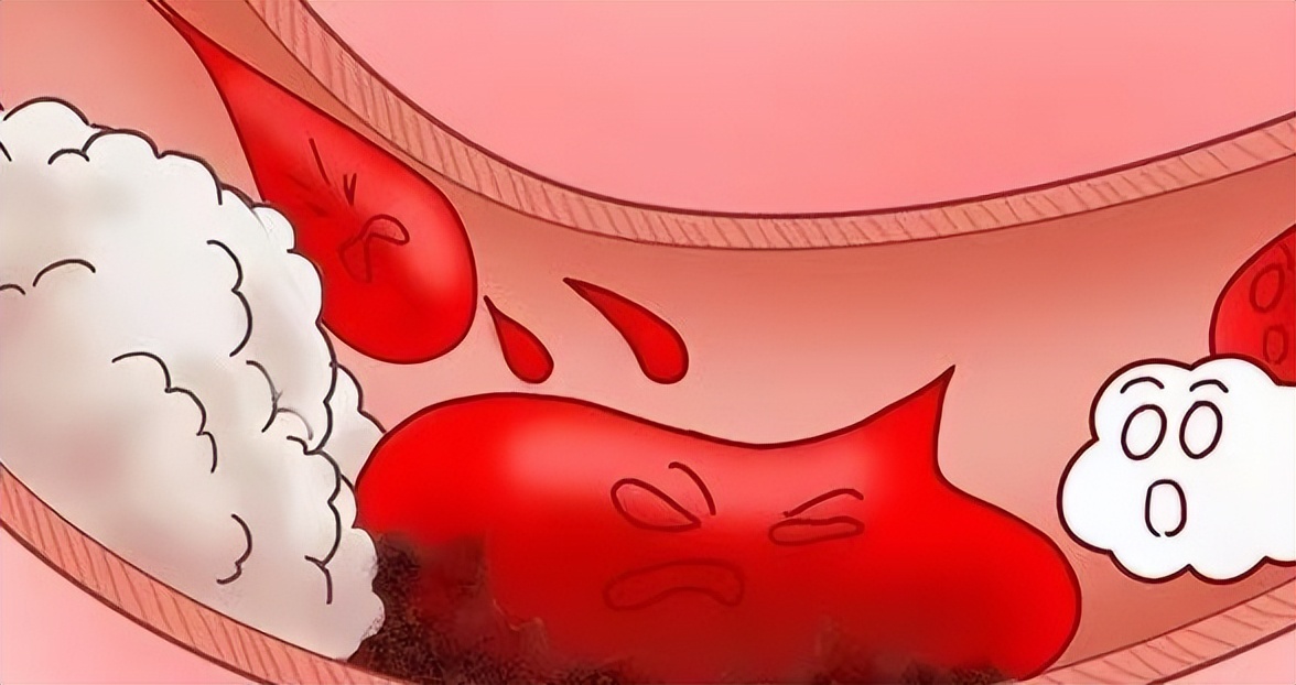 中药桂枝茯苓丸有什么副作用吗,桂枝茯苓丸中哪味药活血化瘀