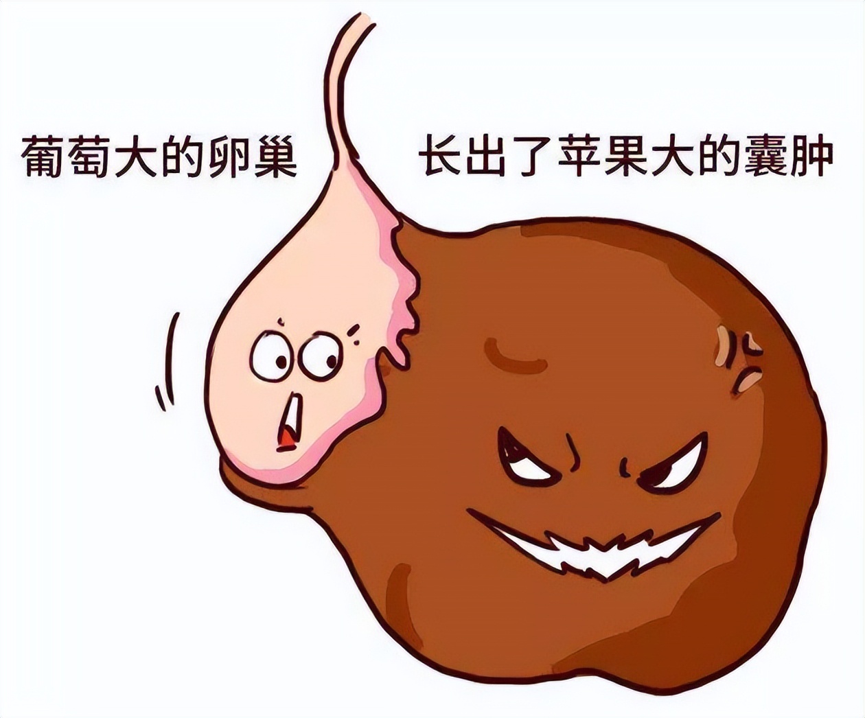 卵巢囊肿有什么症状？出现这4个症状，一定要警惕