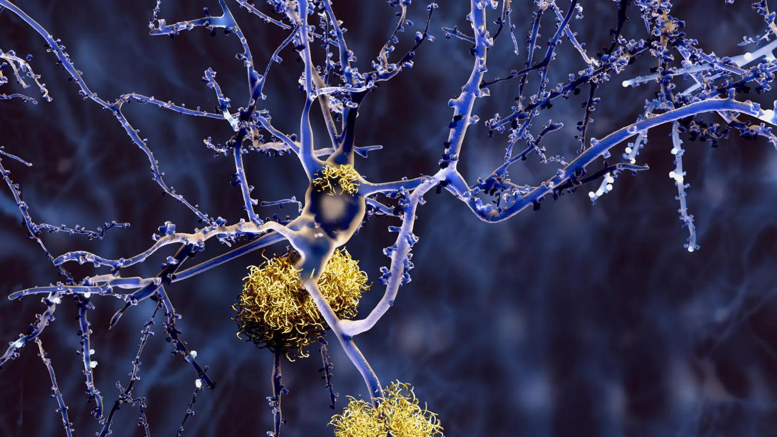 周围有人就尿不出来怎么缓解,旁边有人尿不出怎么回事