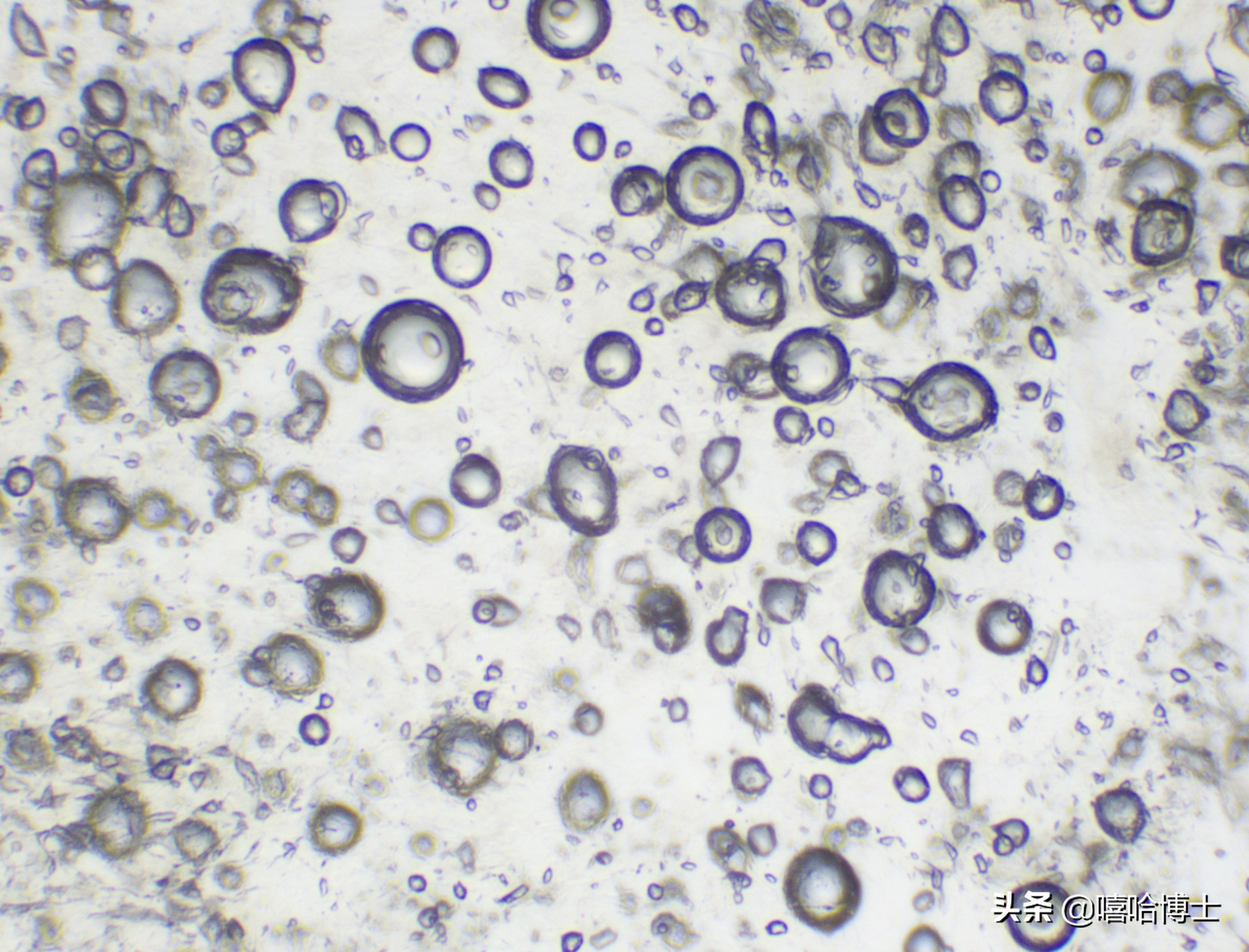 超级显微镜下的山竹,显微镜下的山竹果