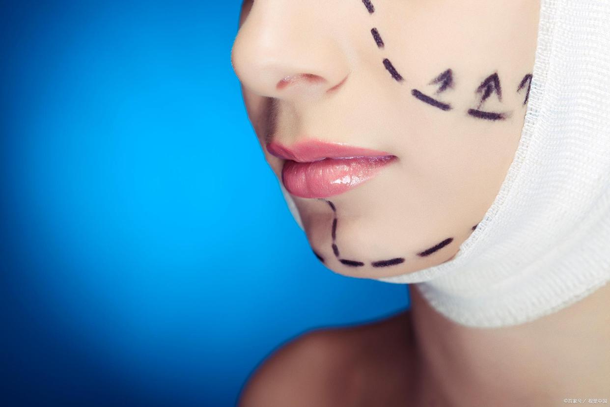 拉皮手术的6个秘密,有做过小拉皮手术的真实案例