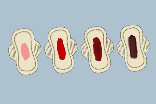 月经结束后为什么有褐色的分泌物,月经完后来褐色分泌物是怎么回事