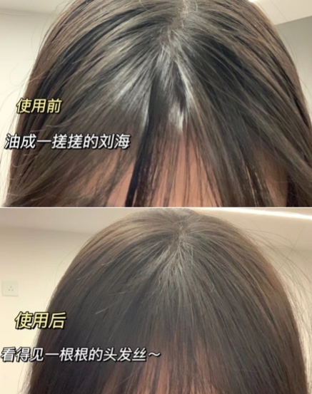 什么洗发水控油不脱发,适合妈妈用的防脱发洗发水