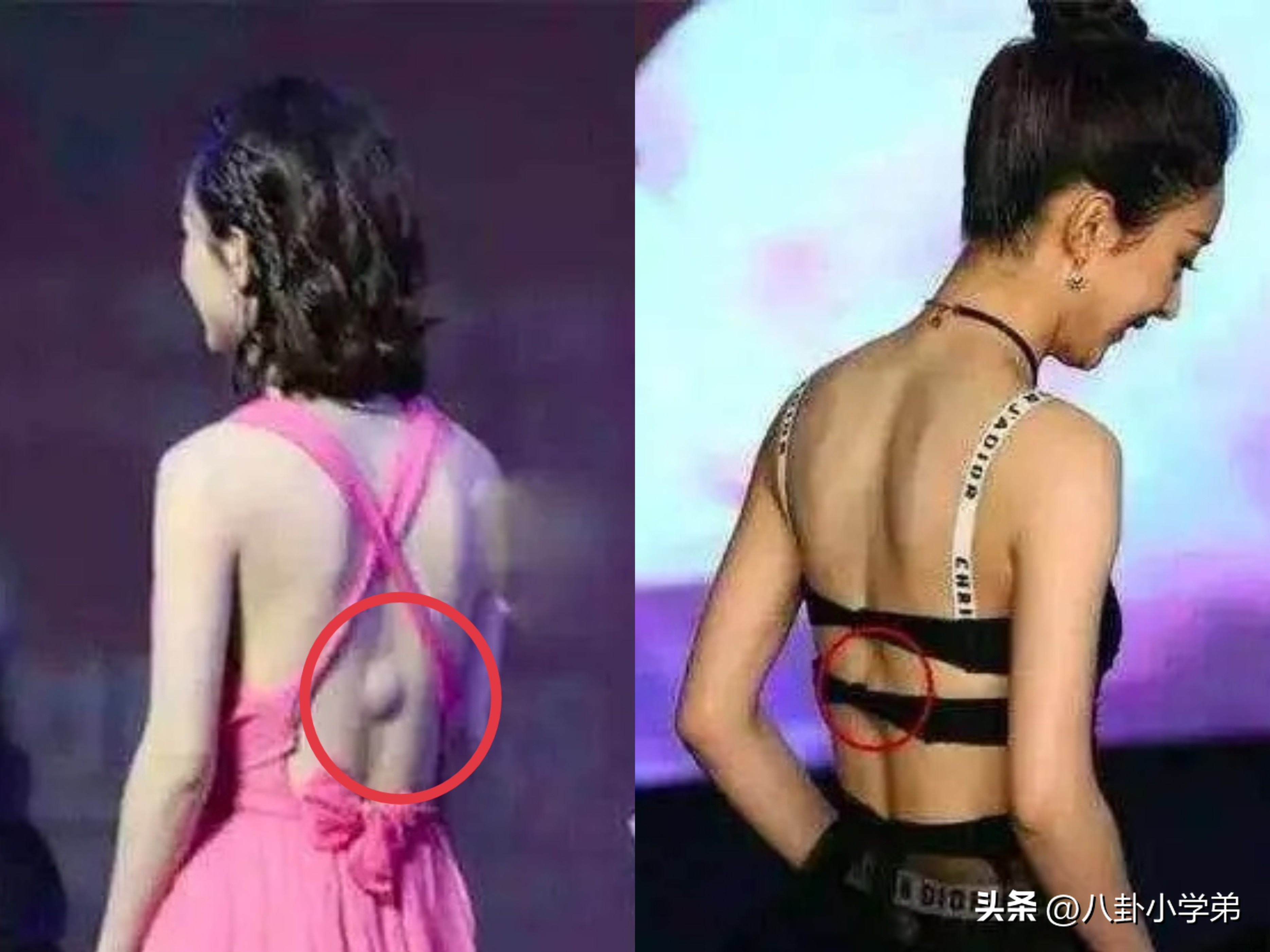 谢霆锋的手，黄晓明的脚，赵丽颖的血栓，让多少“流量明星”脸红