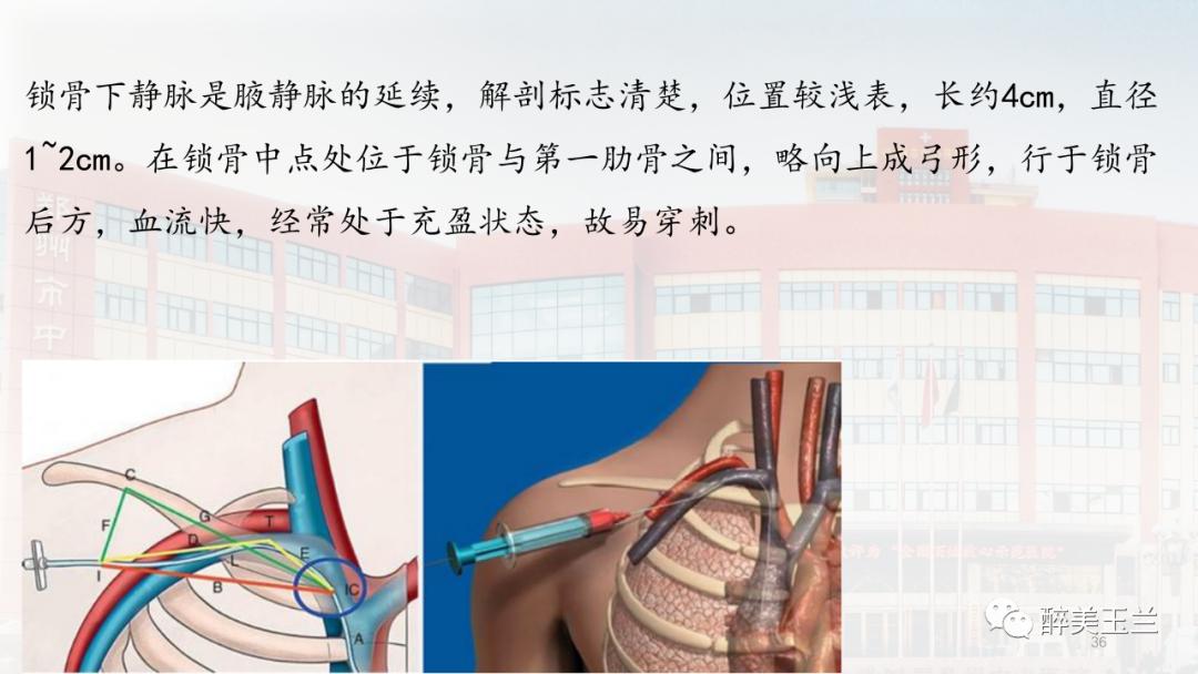 深静脉穿刺置管术讲解ppt,中心静脉穿刺置管深度