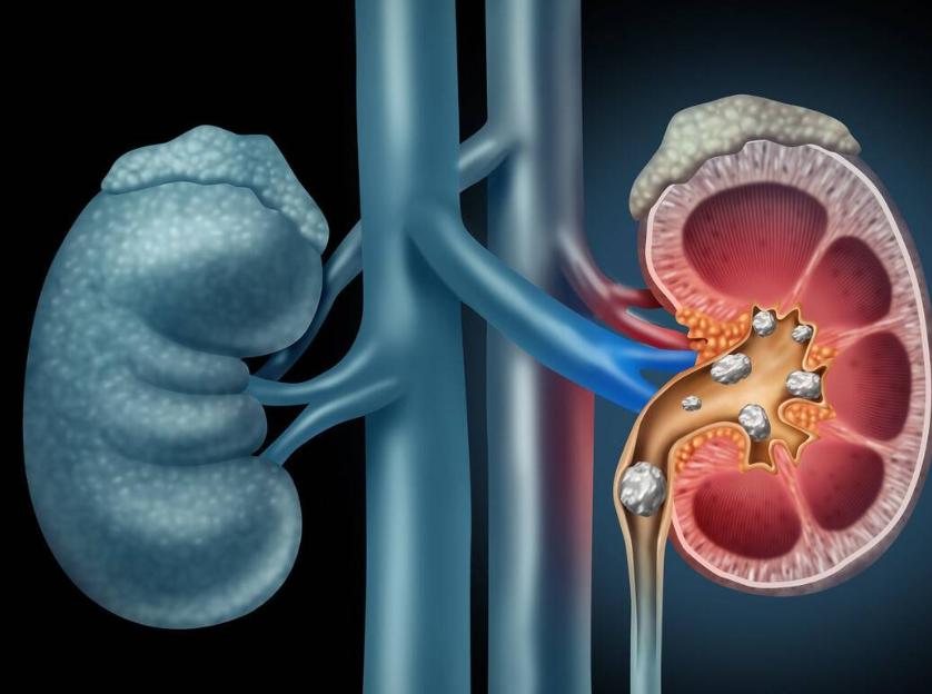 这3种药长期服用很伤胃,这三种药很伤肾提醒建议不要多用