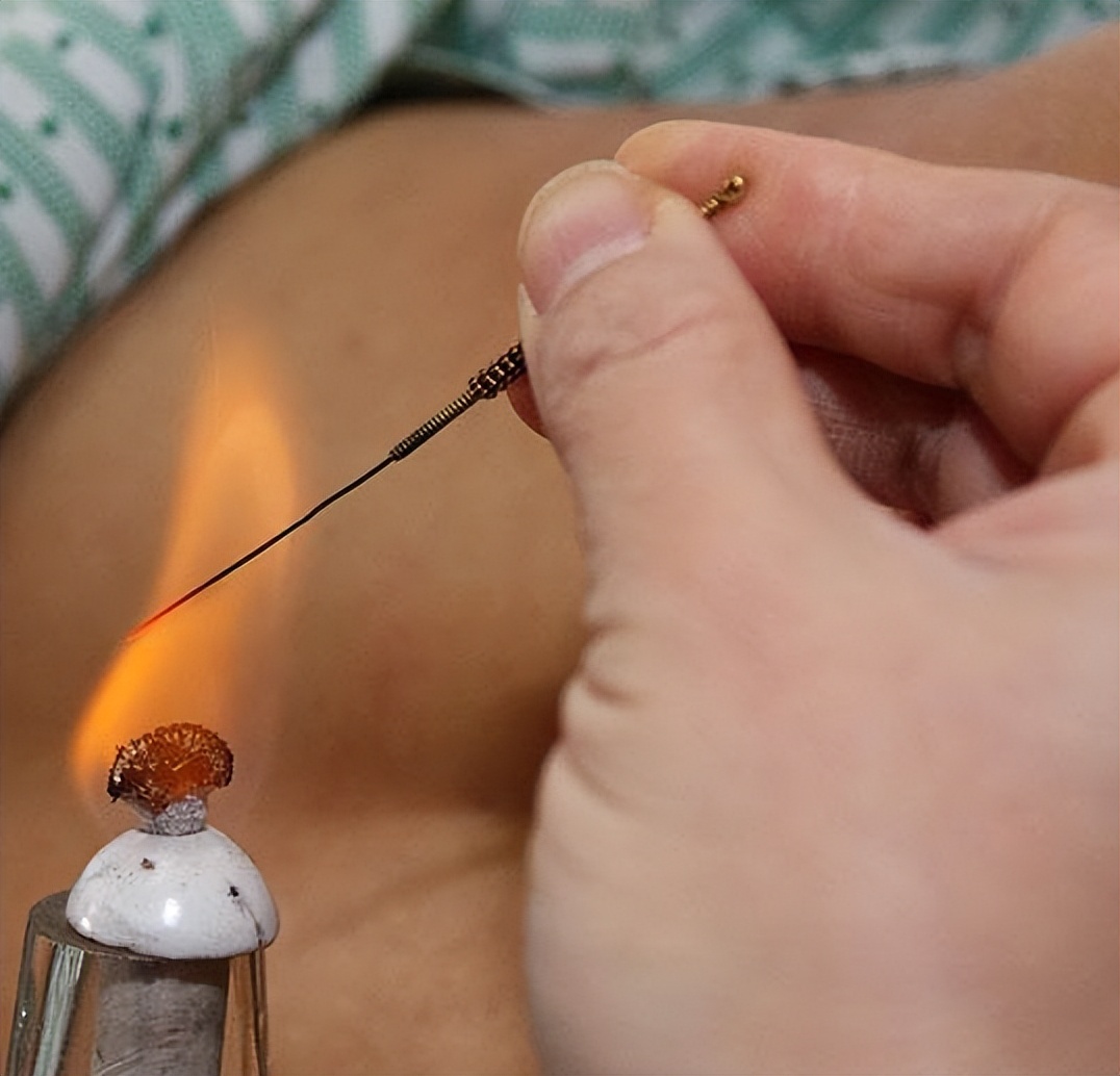 天热湿疹痒痒痒？中医治疗退！退！退！