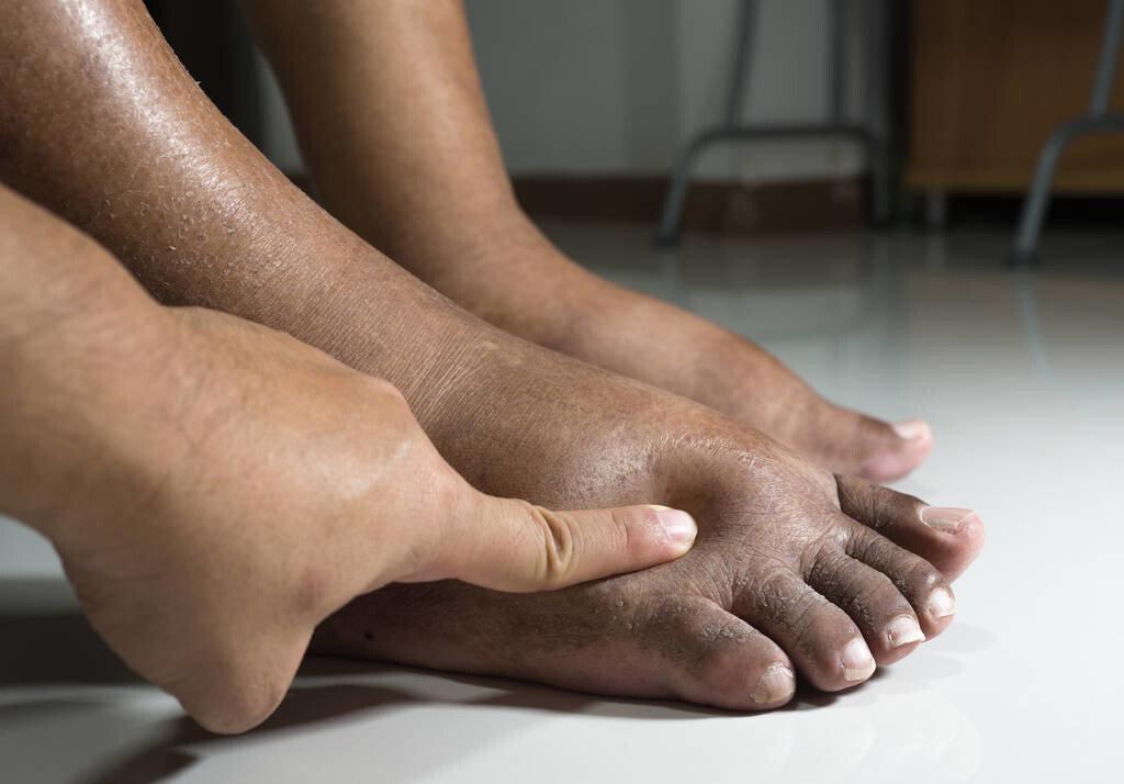 卵巢癌发出的警报有哪些,卵巢癌的早期信号会有哪些