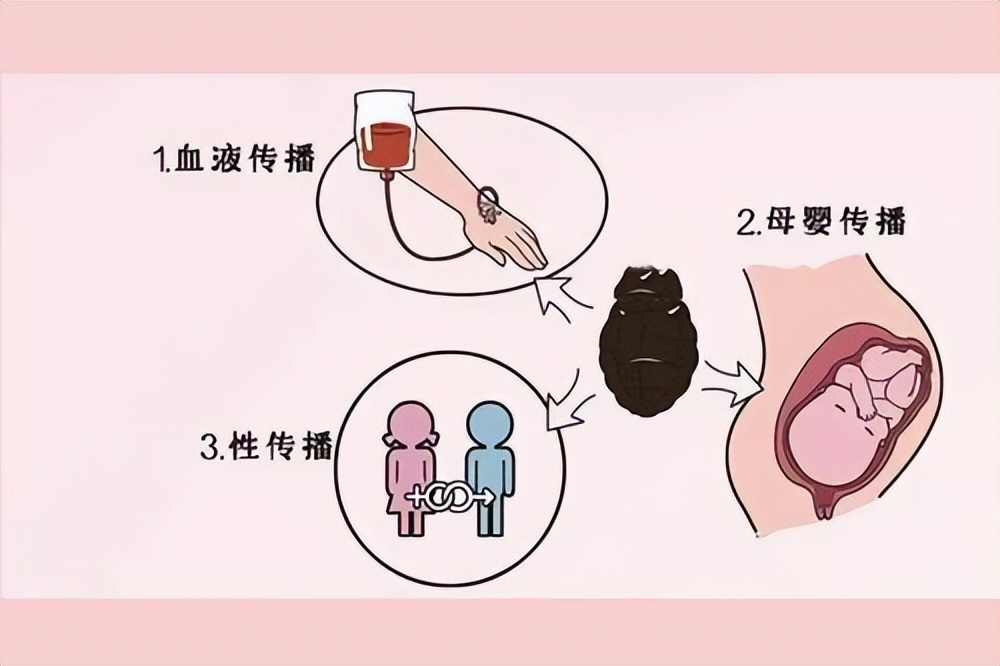 梅毒初期是什么症状梅毒怎么治,得了梅毒会有什么症状