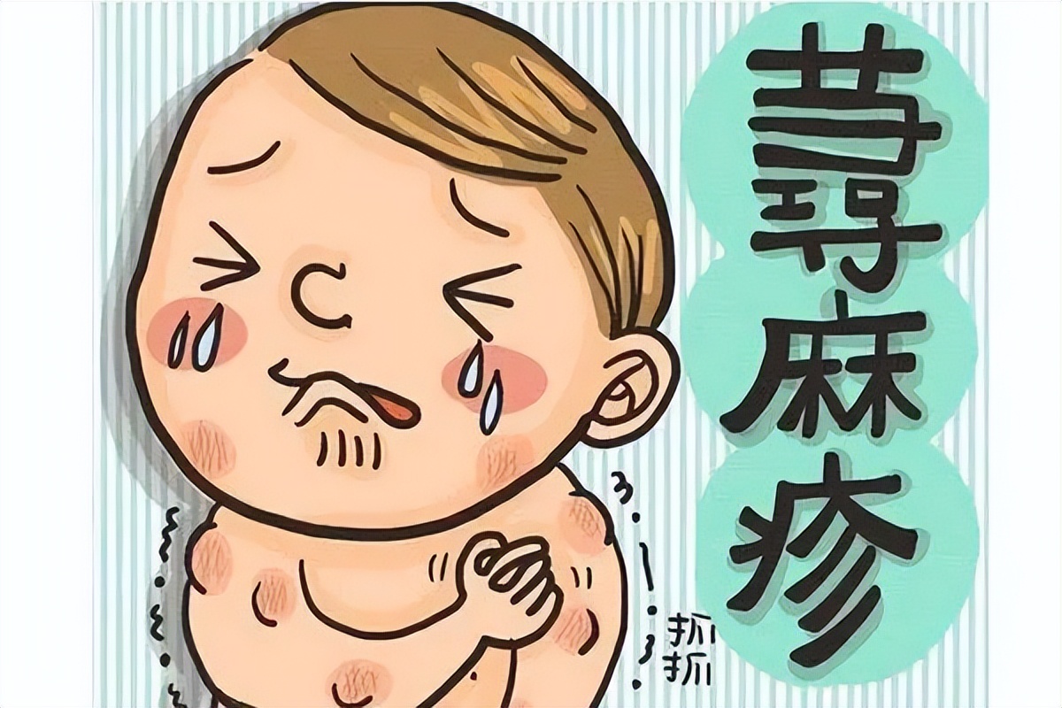 麻疹有什么忌口,麻疹饮食要注意一百天吗