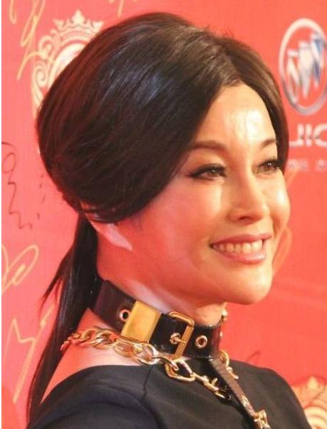 老演员整容脸变形,老年人整容前后照片