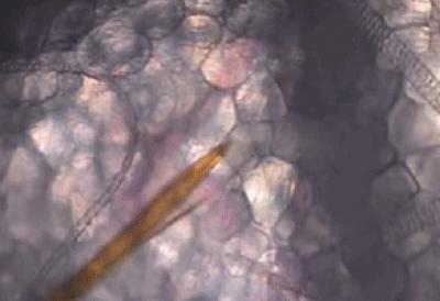 收走蚊子的作案工具,没收蚊子的工具