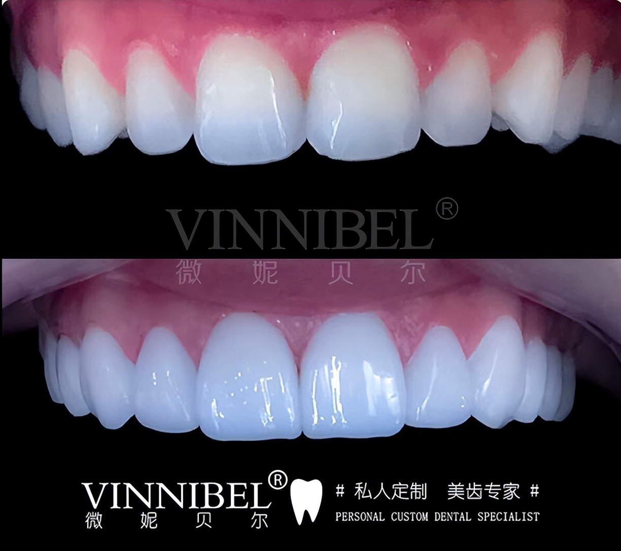 微妮贝尔,美齿专业私人订制