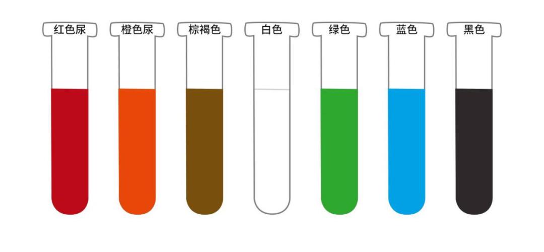 上午尿液颜色深下午尿液颜色无色,尿液颜色像菊花茶的颜色