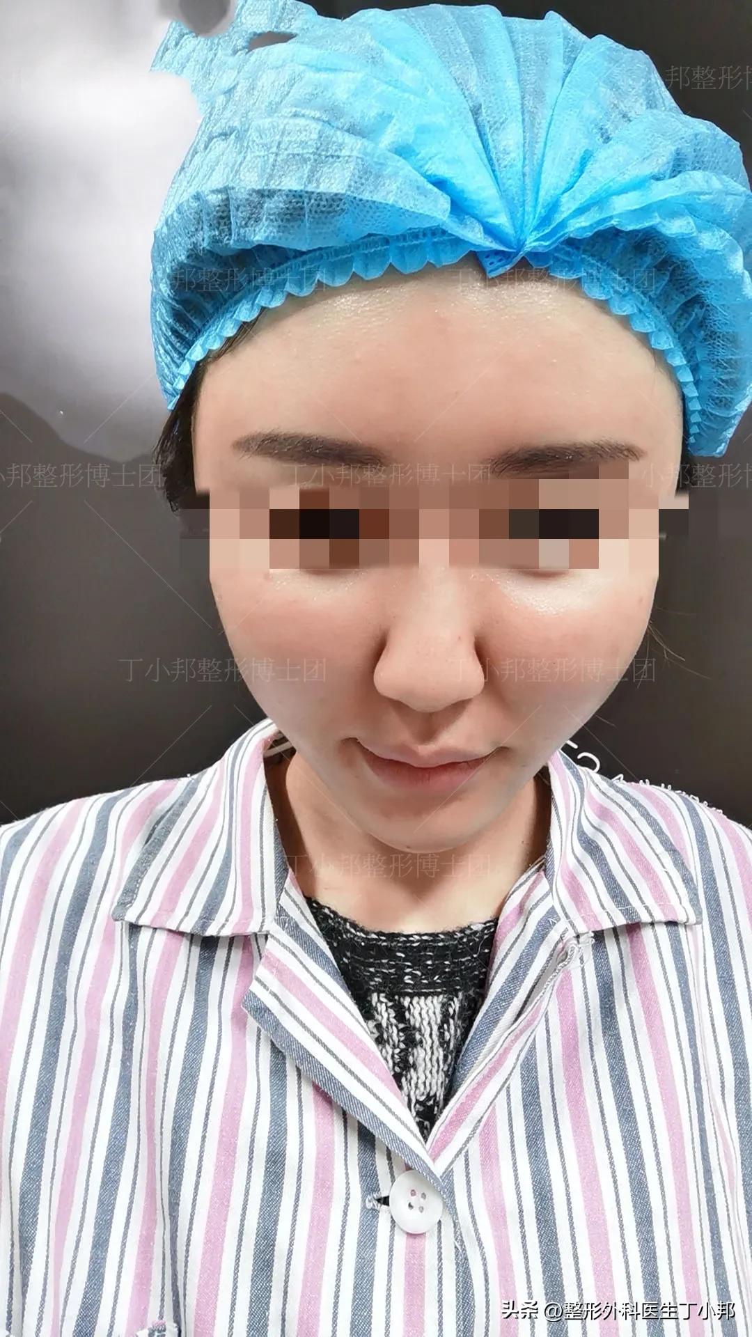 一个小姑娘毁容,一个女的毁容后才知道是救了自己