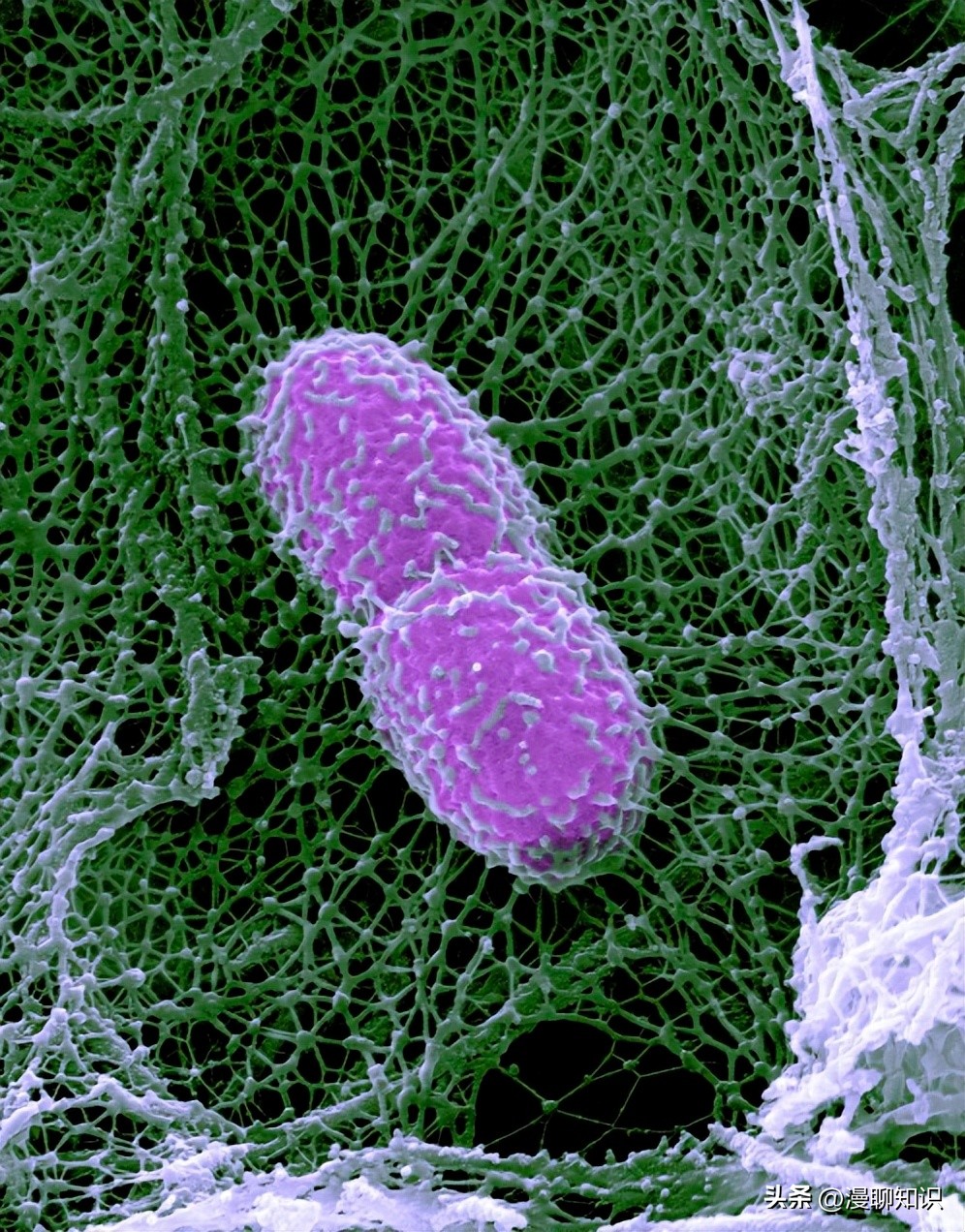 老年人得了肺炎应如何有效医治,肺炎有多严重怎么办