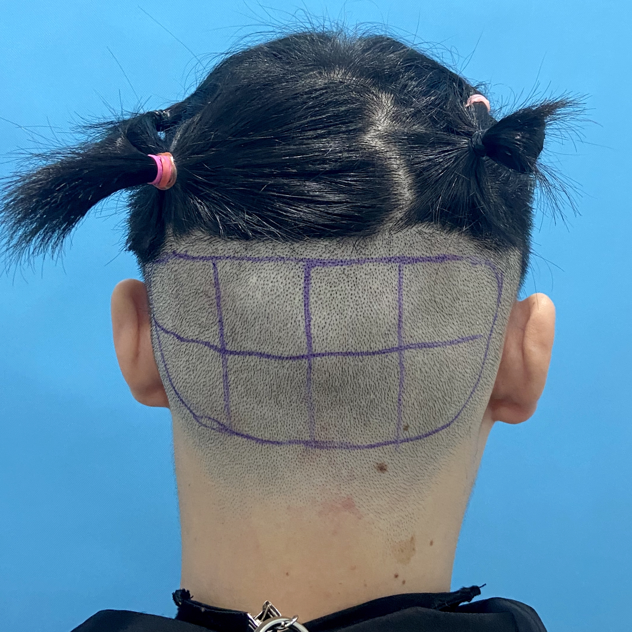 涓轰粈涔堟鍙戜簡杩樻槸鑴卞彂,妞嶅彂澶辫触璧斿灏戦挶