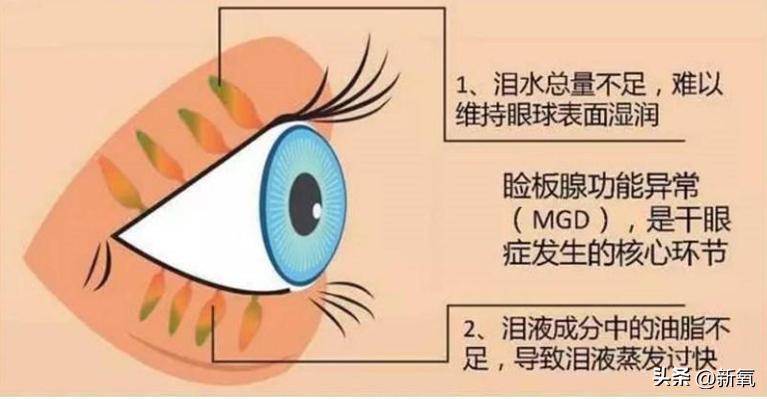 眼睛怎么才能变成星星眼,怎么让眼睛变星星眼