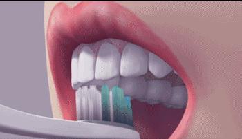 儿童用电动牙刷好还是普通好,儿童电动牙刷适合每天用吗