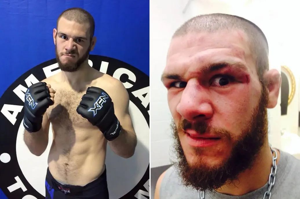 职业拳击手跟普通人打架,职业拳击手被混混打死