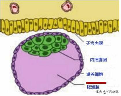 葡萄胎容易怀上怪胎吗,葡萄胎是不是怪胎