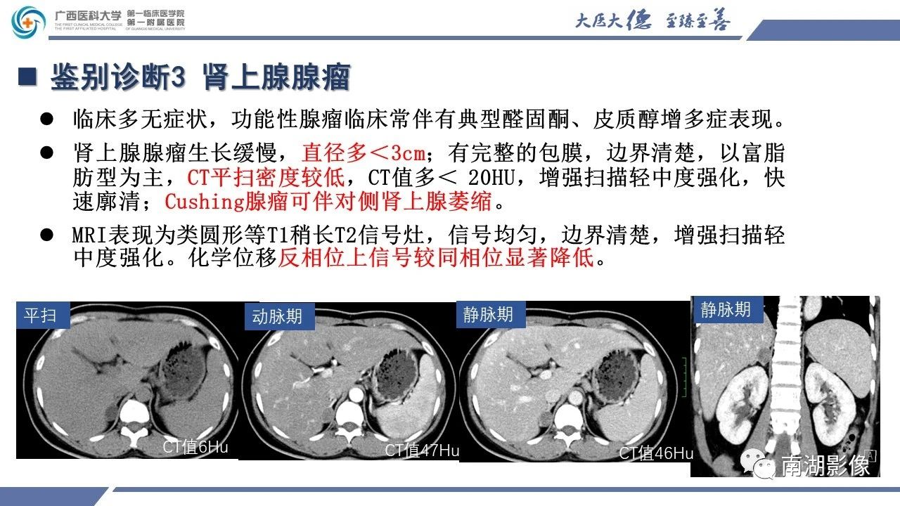 肾上腺海绵状血管瘤,肾上腺血管瘤是良性还是恶性