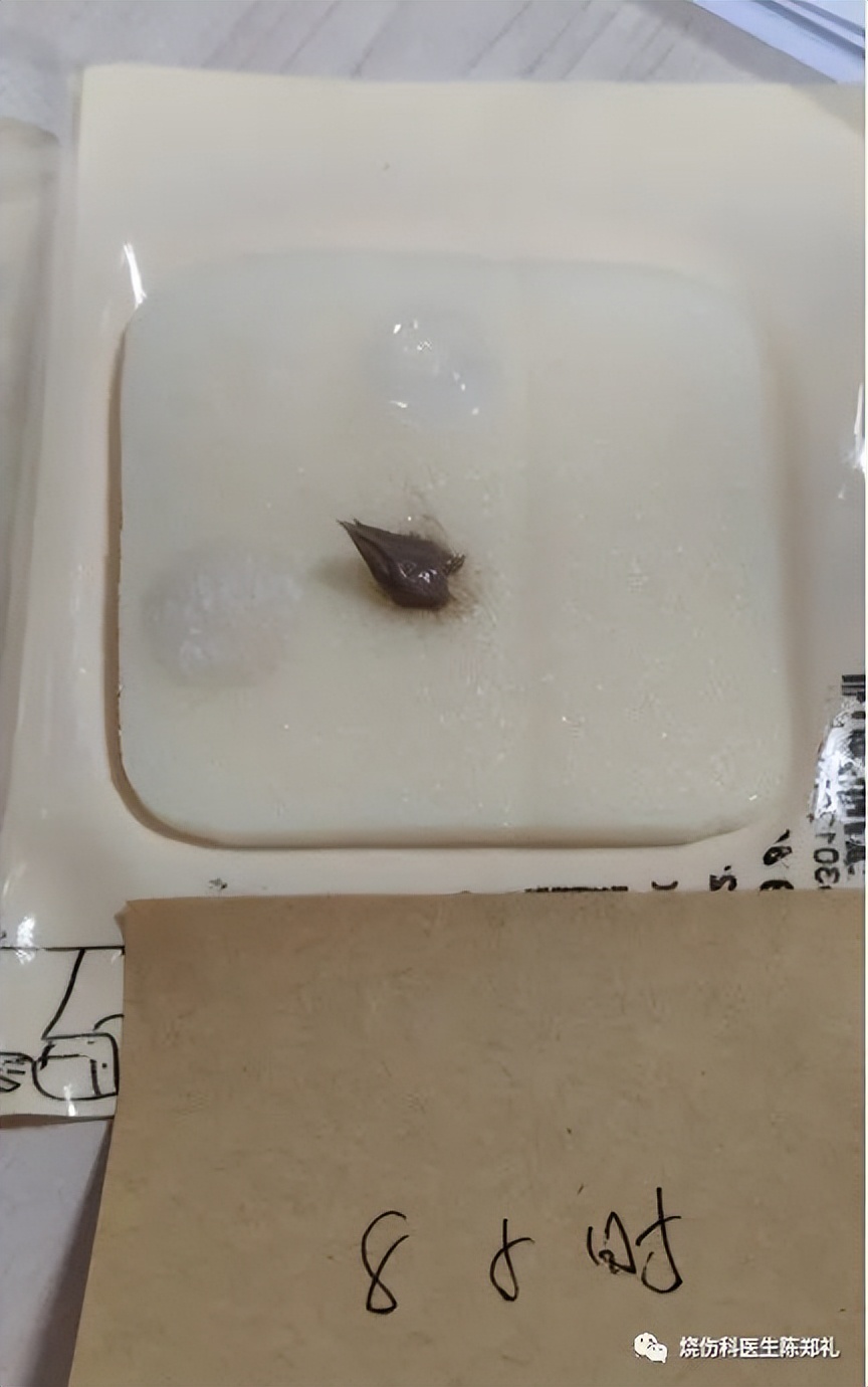 创面外用药物及敷料的使用策略及理论依据