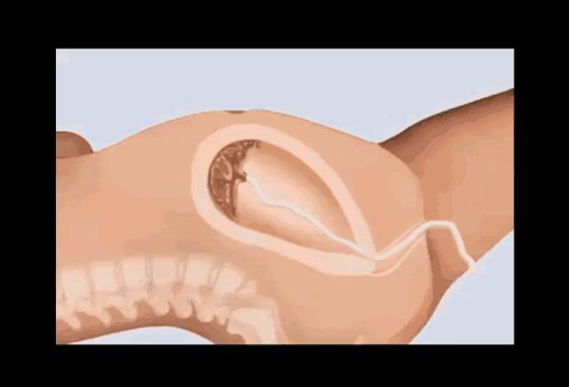 女人生孩子“开十指”全过程曝光，没人能笑着看完