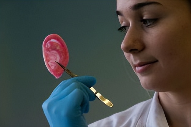 人工器官发展的必要性,人工器官目前的研制和应用