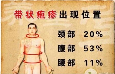 带状疱疹后遗神经痛针灸治疗方法,舒卿针灸治疗带状疱疹后遗神经痛