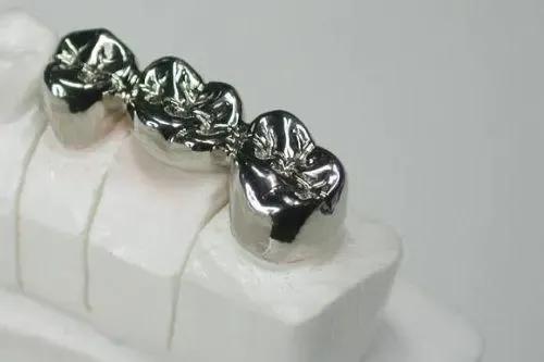 一分钟带你了解各种假牙,假牙基础知识