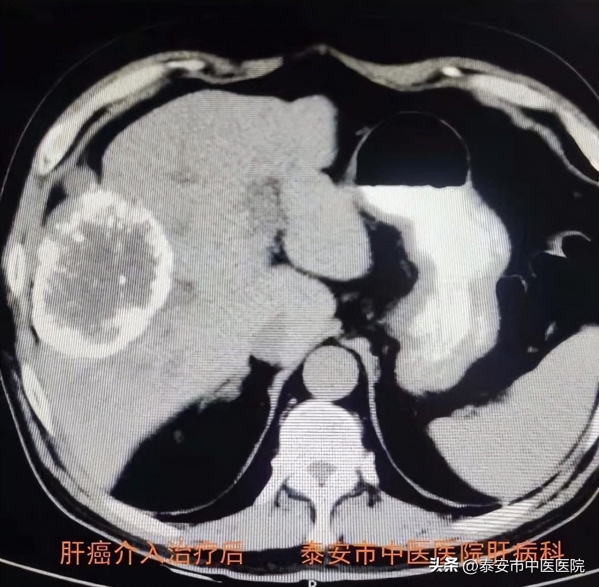 医心向党踔厉奋进直播,医心向党致敬医师节