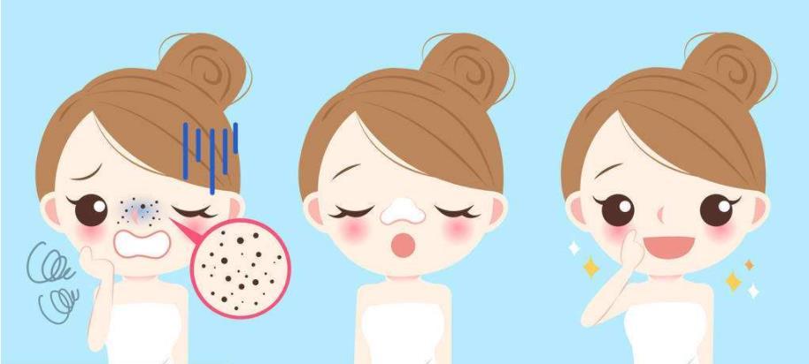 别再胡乱去除鼻子黑头专家告诉你,如何去挤黑头不会脱皮