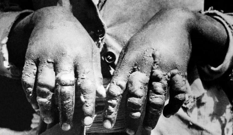 日本侵华老兵来黑龙江,日本老兵来南京和受害幸存者见面