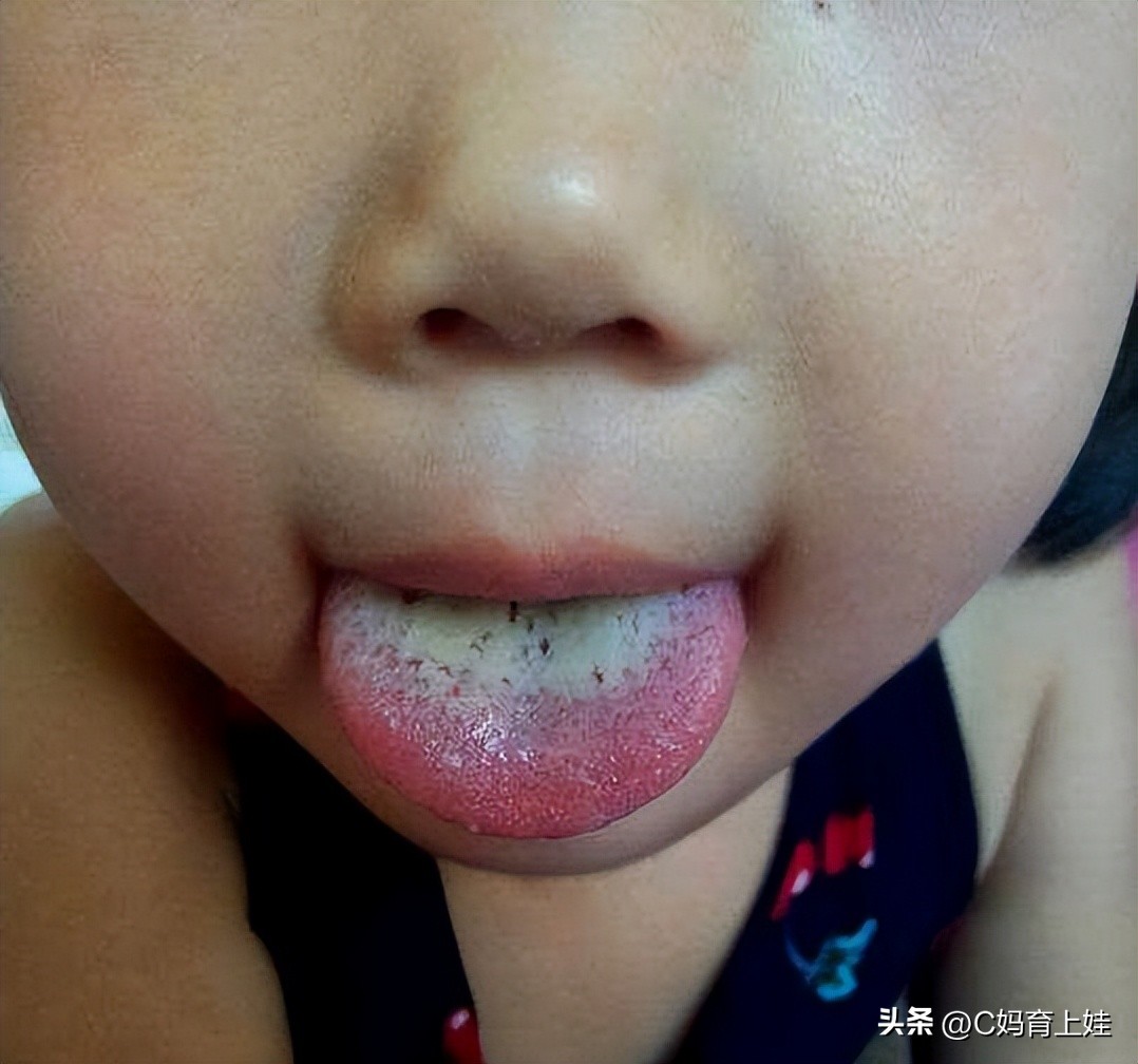 5岁男宝体重57斤正常吗,5岁男孩体重66斤