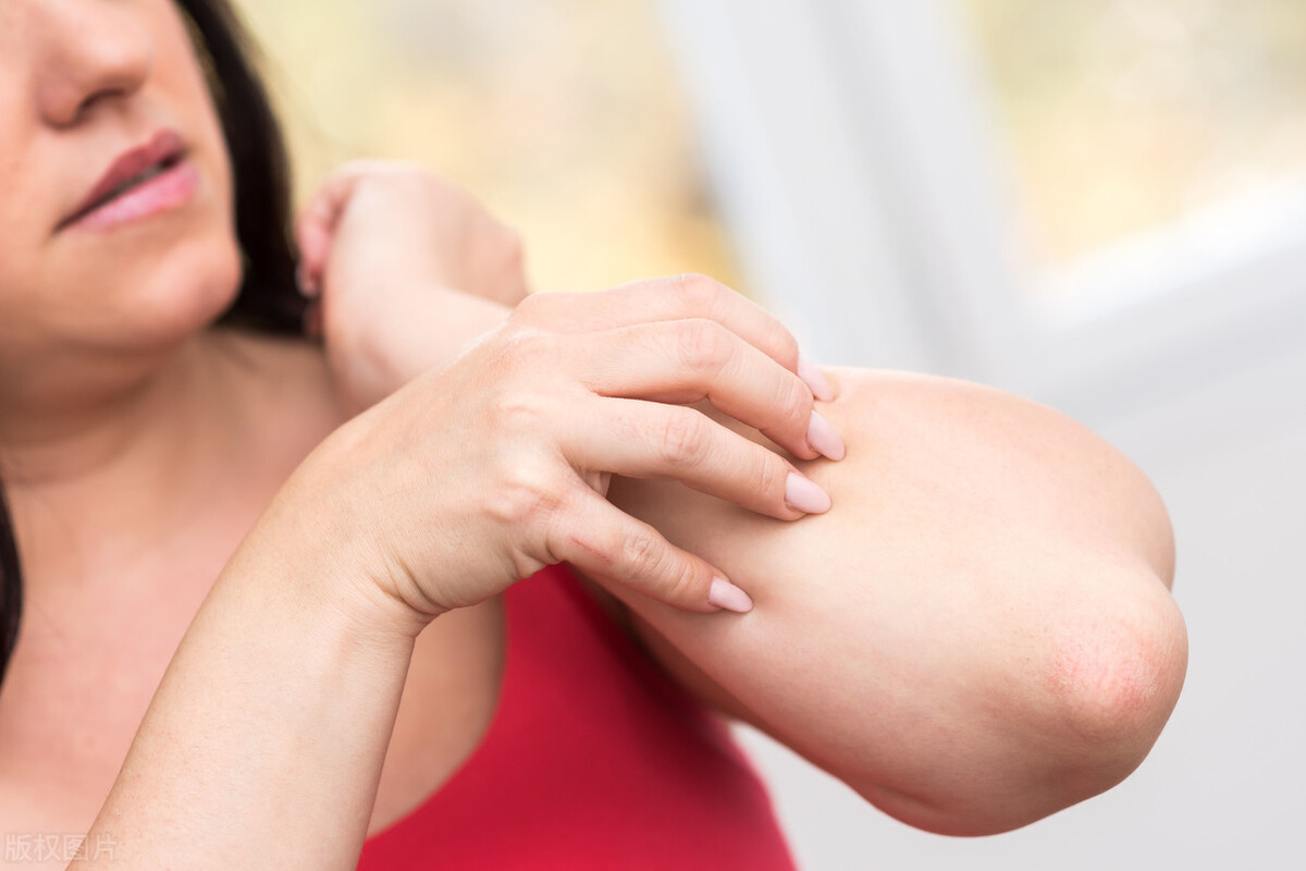 被蚊子叮了怎么止痒比较有效,被蚊子叮了快速止痒的方法