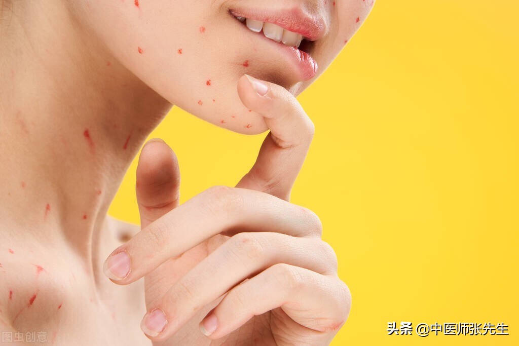 全身丘疹的病因分析及中医治疗方法