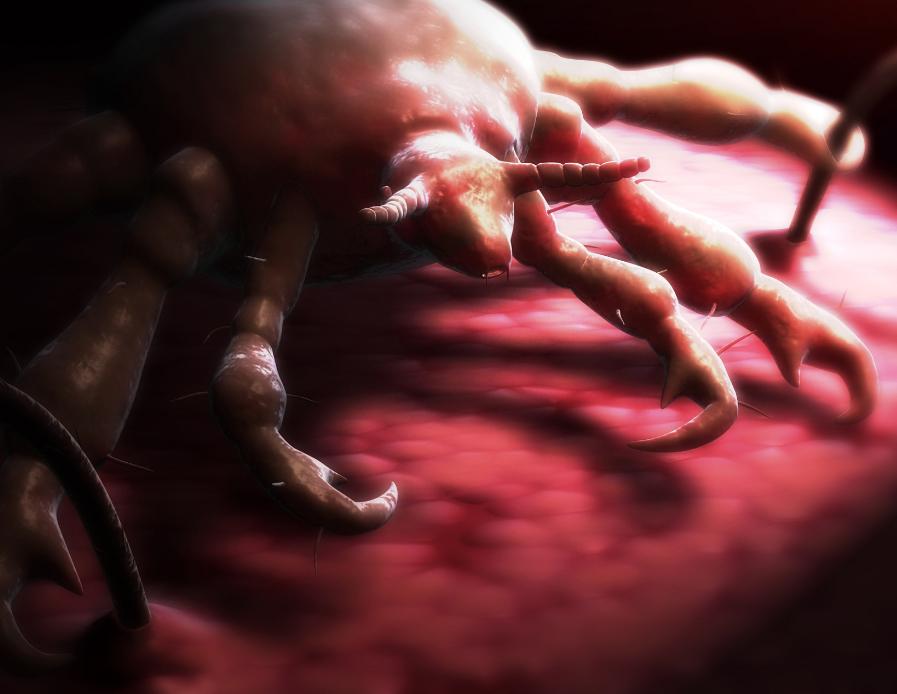 医生检查阴虱的镊子和刀片,男子发现阴虱