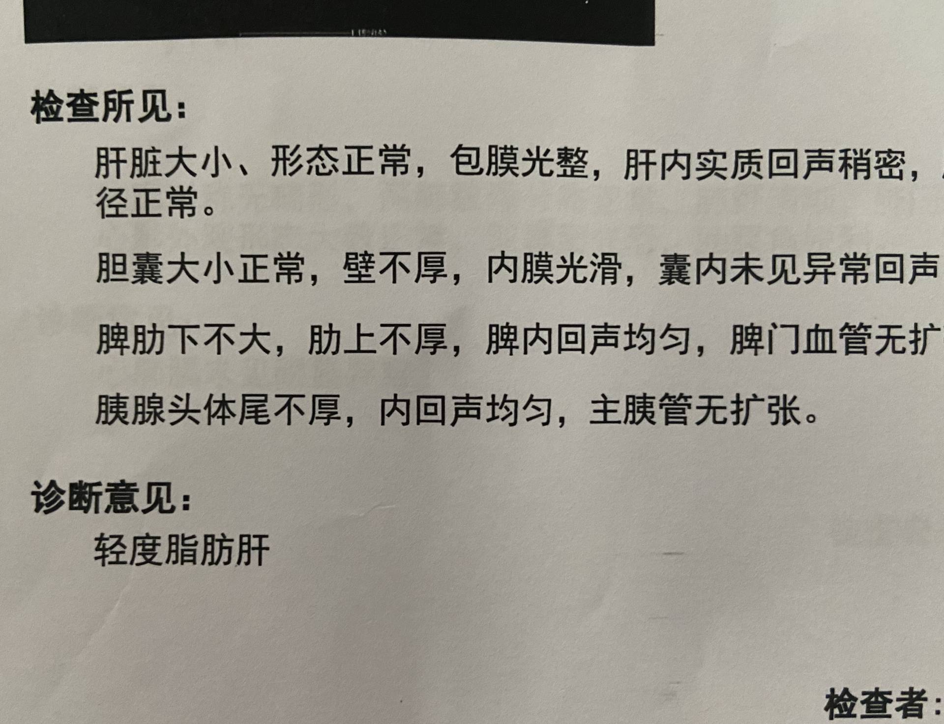 划船机和单车哪个减脂效果好,用划船机减脂一般要拉到多少
