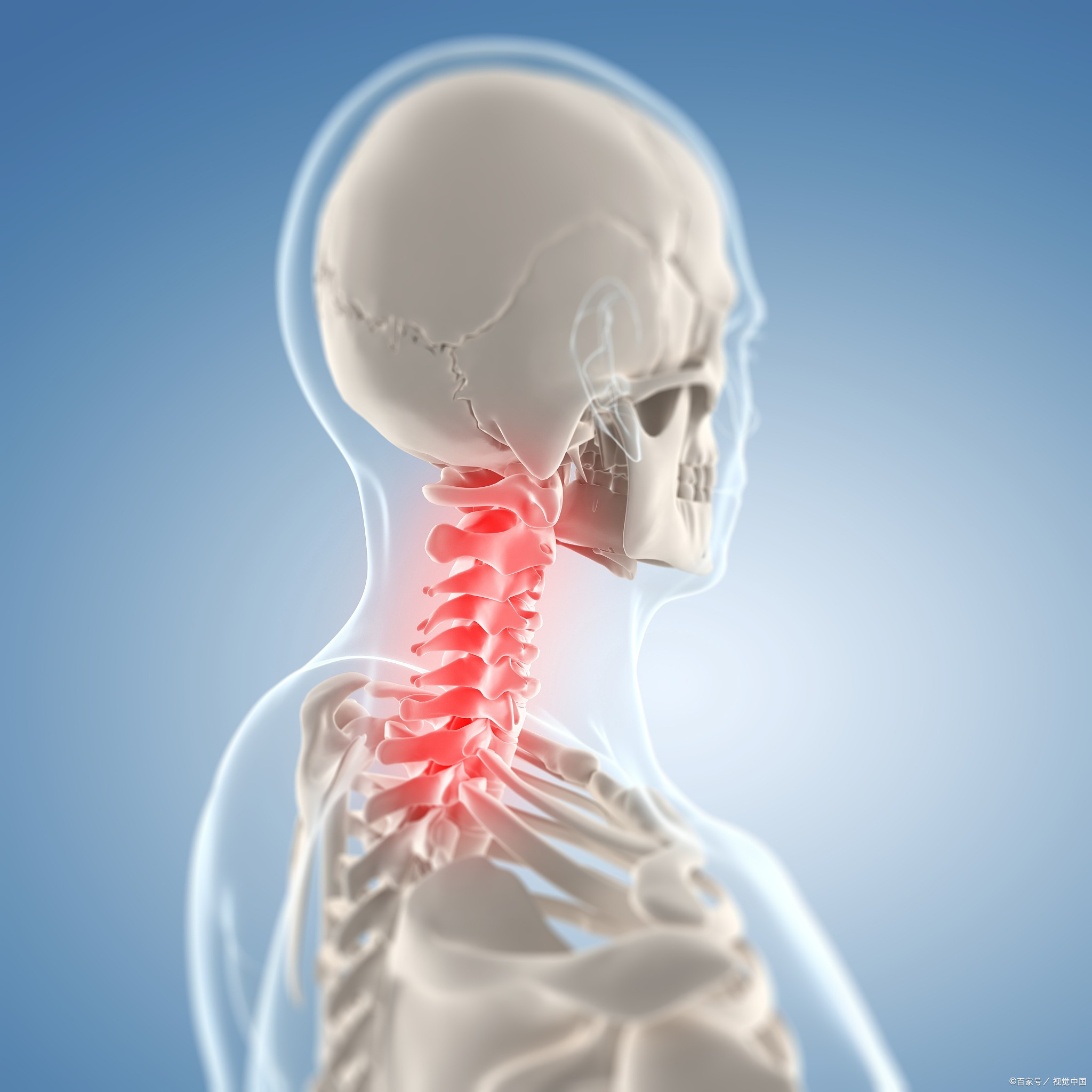 大夫，我得了颈肩综合征，怎么办？