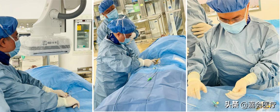 肝癌持续动脉灌注化疗注意事项,肝癌经肝动脉栓塞化疗