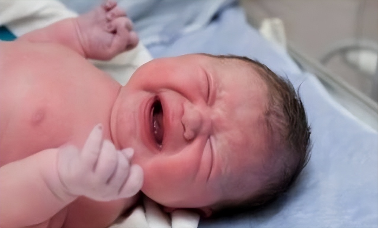 肾盂分离超过1厘米就是肾积水吗,左肾肾盂分离约5mm是什么意思