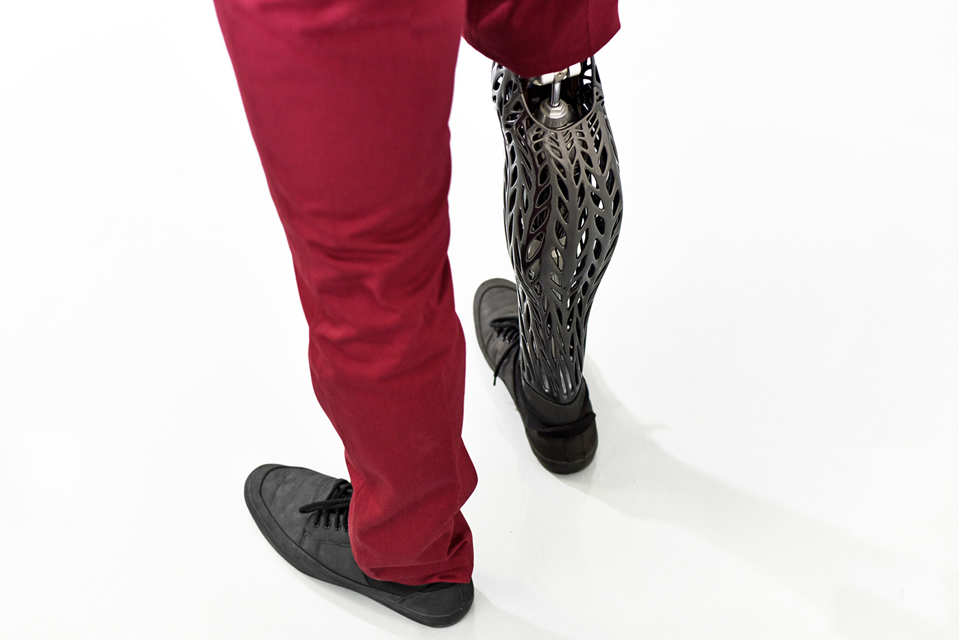 活蛆的另类妙用?一战时用蛆清创,几百条蛆曾挽救即将截肢的病患