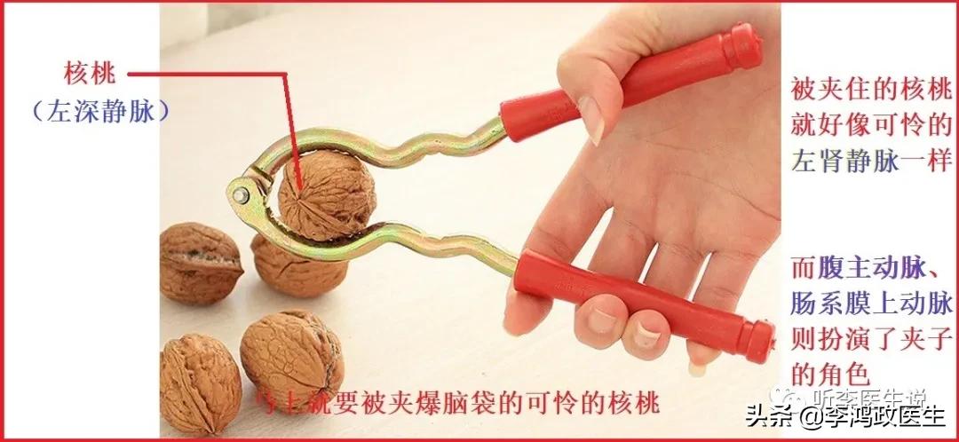 女子腰椎突出腰痛,女子腰椎间盘突出