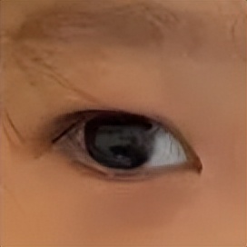 三岁女童被感染,三岁女孩感染病毒