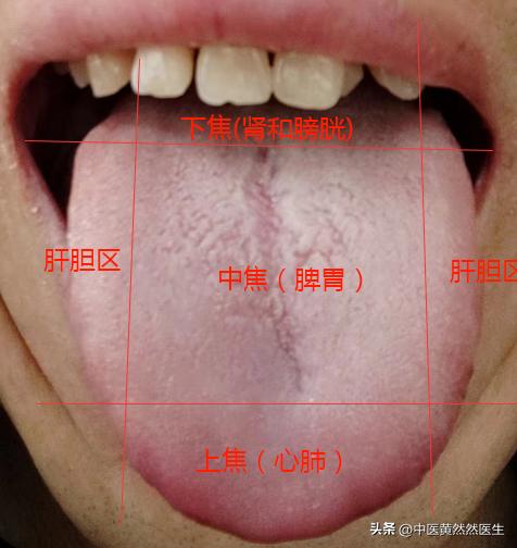 硬度差、中途疲软、阴部瘙痒和这个舌象有什么关系？