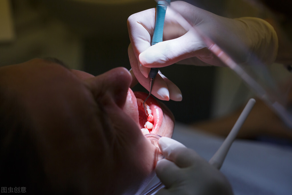 智齿拔掉怎么处理坏牙,拔烂牙和智齿有区别吗