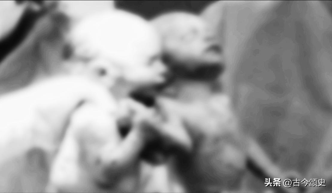 连体人结婚生子,连体人如何生子