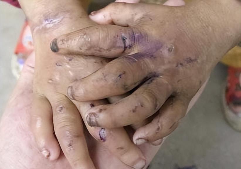 后妈虐待女童最新案件,后妈虐待13岁孩子新闻